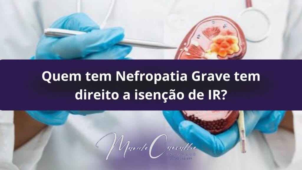 Quem tem Nefropatia Grave tem direito a isenção de IR?